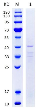 12% SDS-PAGE analysis profiles of purified Human DNM2 protein (a.a.533-824) (CBB stained).
